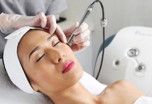 Quy trình bắn laser trị nám hiệu quả và an toàn nhất