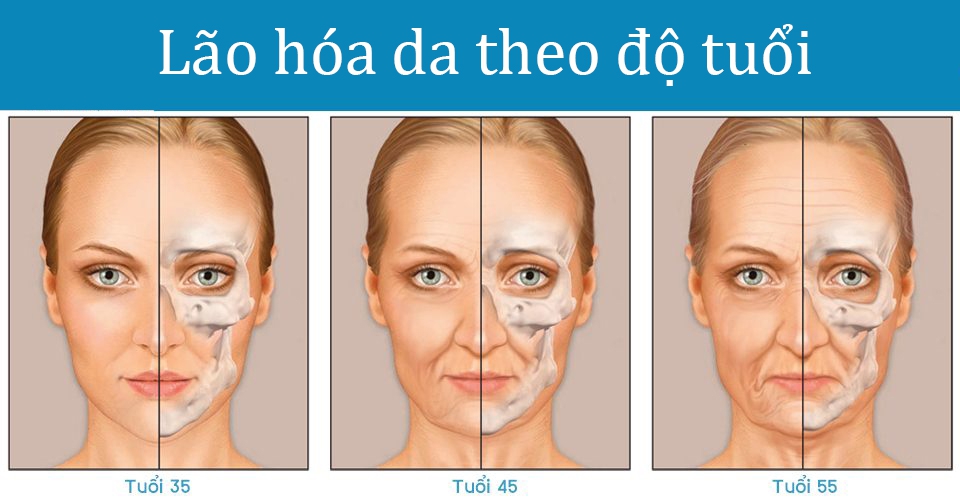 Tuổi càng cao thì vấn đề lão hóa da càng nghiêm trọng hơn