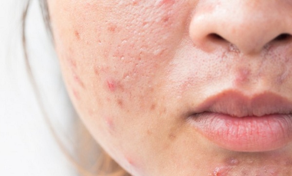 Lựa chọn kem chống lão hóa hợp lý với từng độ tuổi để tránh phản tác dụng
