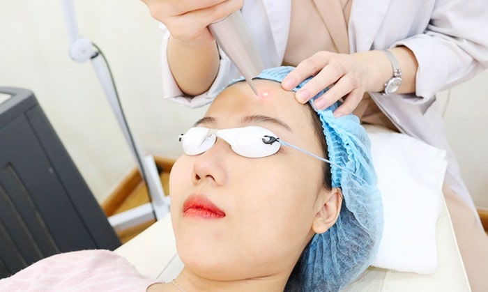 Nên áp dụng cách trị nám da khi nào?