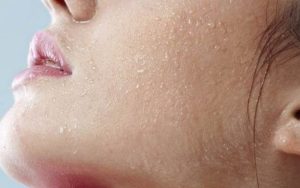 Phân biệt da thiếu nước và thiếu ẩm