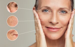 Chống lão hóa da tuổi 30 là việc làm rất quan trọng