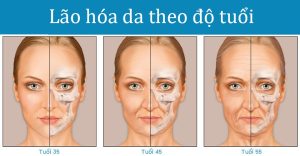 Tuổi càng cao thì vấn đề lão hóa da càng nghiêm trọng hơn