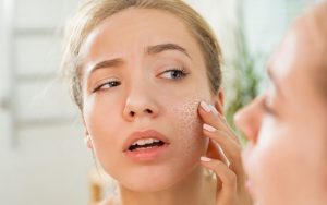 Da khô sẽ là một yếu tố thúc đẩy quá trình lão hóa da sớm diễn ra